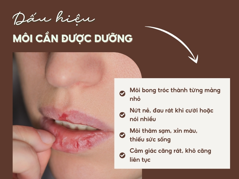 Các biểu hiện của việc môi khô, nứt nẻ đang cần dưỡng