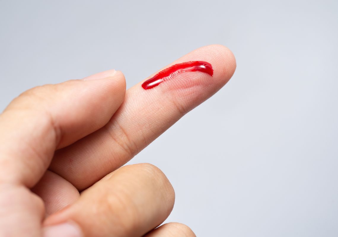 ngón tay bị chảy máu
