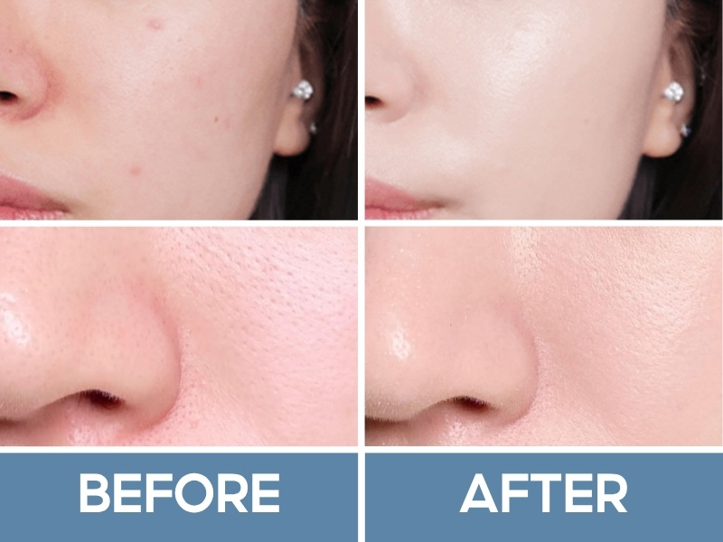 Trước và sau khi đánh fwee Glass Cushion Foundation
