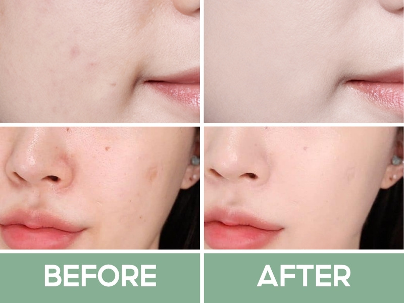 Trước và sau khi đánh Laneige Neo Cushion Matte