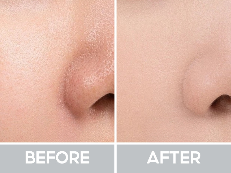 Trước và sau khi đánh Romand NU Zero Cushion