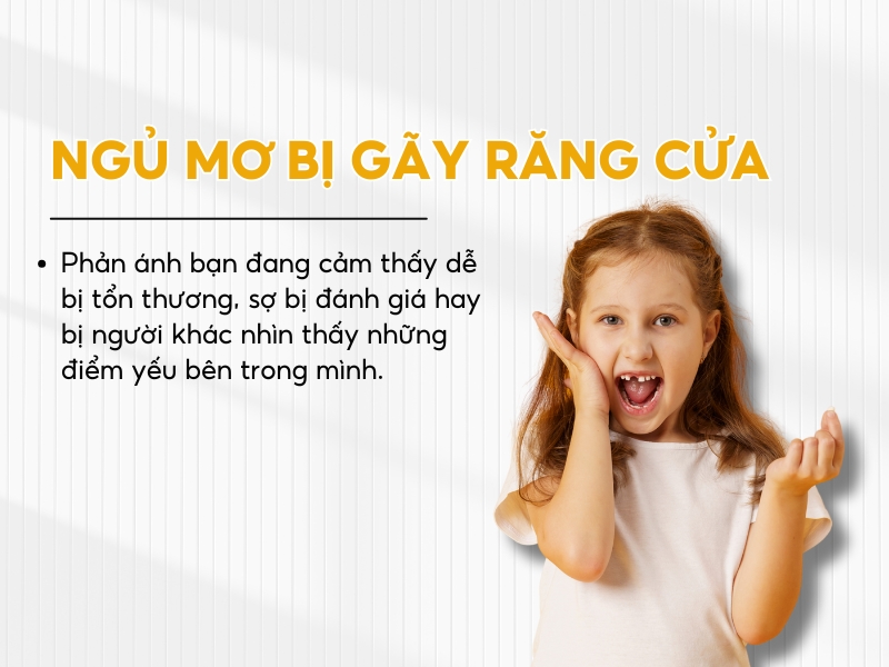 Giải mã việc nằm mơ bị gãy răng cửa