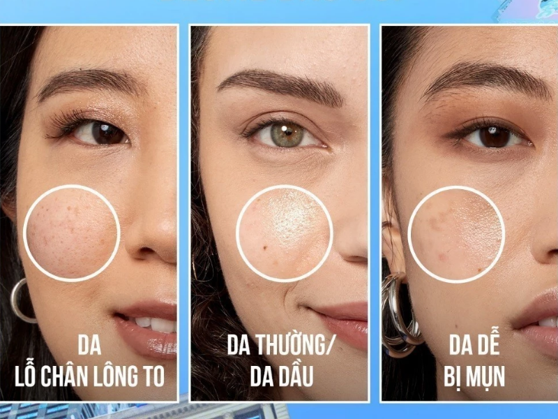 Kem nền Fit Me Foundation cho da mụn