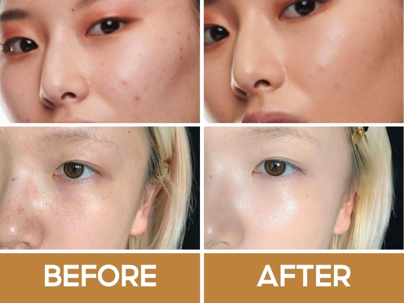 Trước và sau khi đánh nền MAC Studio Radiance Serum