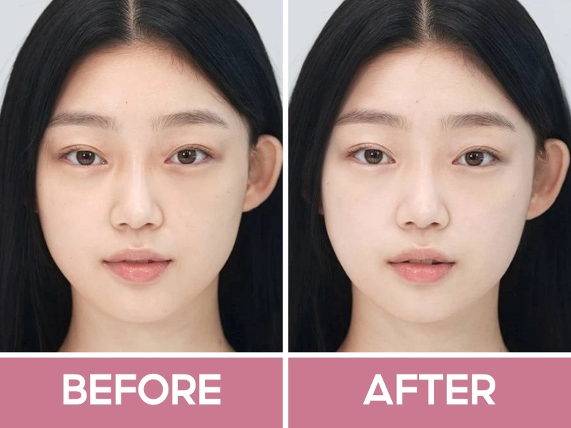 Trước và sau khi đánh Glow Breathable BB Cream