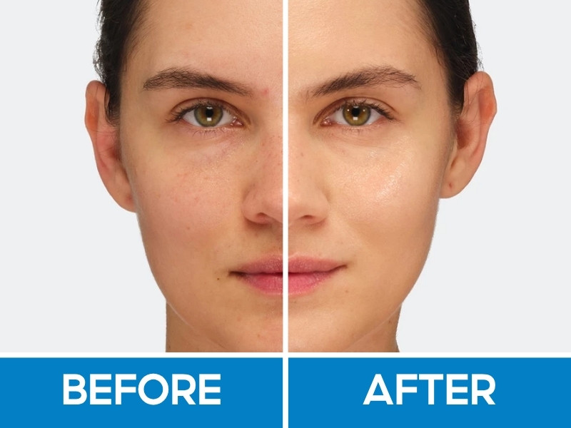 Trước và sau khi đánh Make Up For Ever Hydraglow 