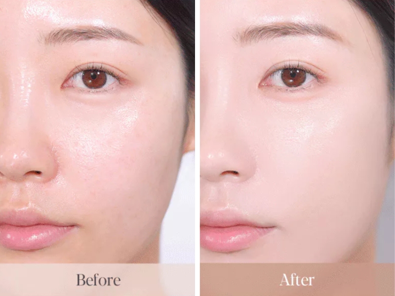 So sánh da trước và sau sử dụng Espoir Be Glow Foundation