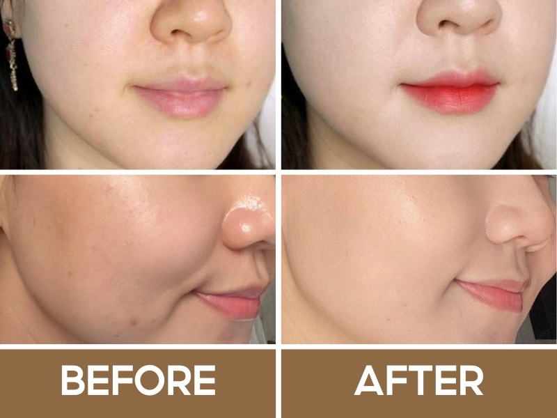 Trước và sau khi đánh Whoo Gongjinhyang Brightening BB Cream
