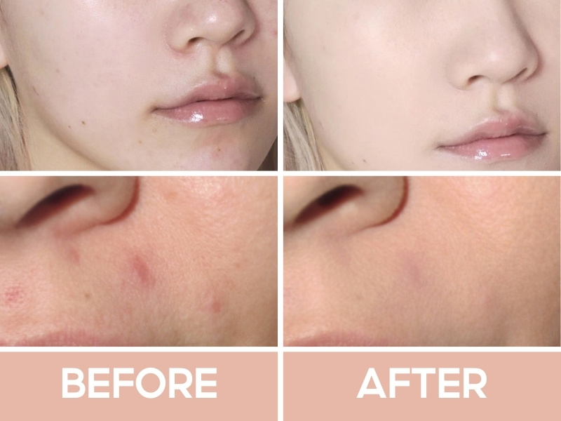 Trước và sau khi đánh kem nền Nars Soft Matte 
