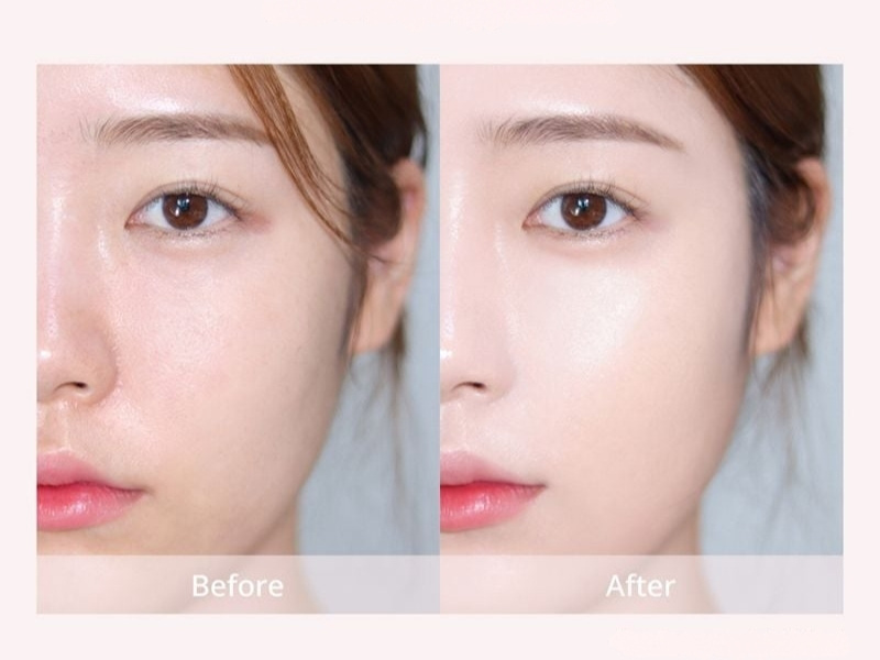 Trước và sau khi đánh kem nền Clio Kill Cover