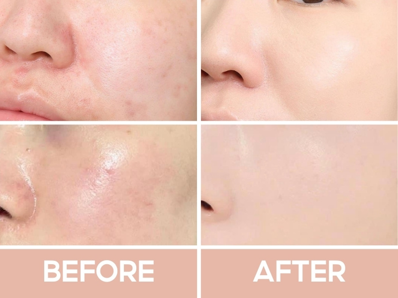 Trước và sau khi đánh nền Estee Lauder Double Wear