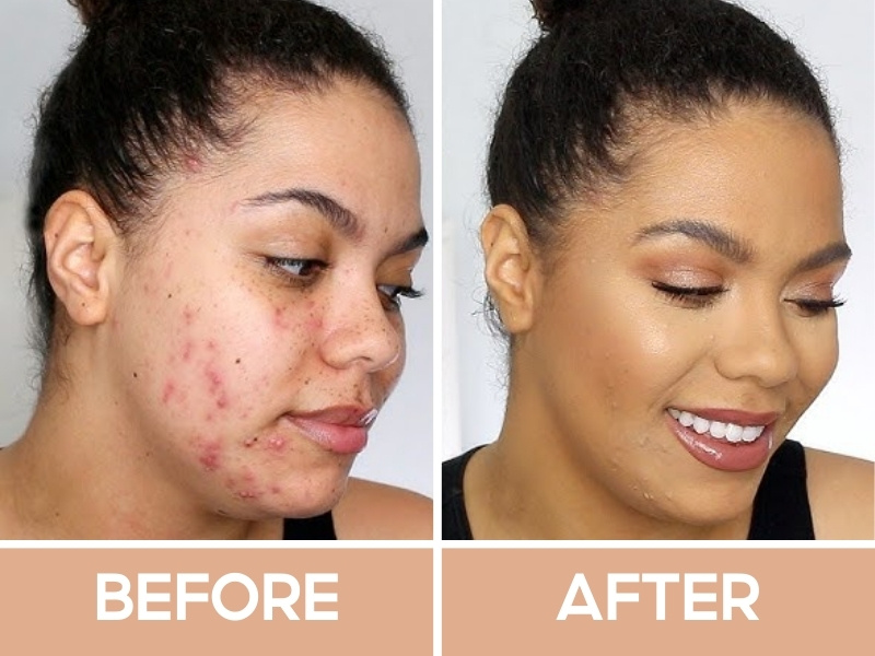 Trước và sau khi đánh kem nền Nars Natural Radiant