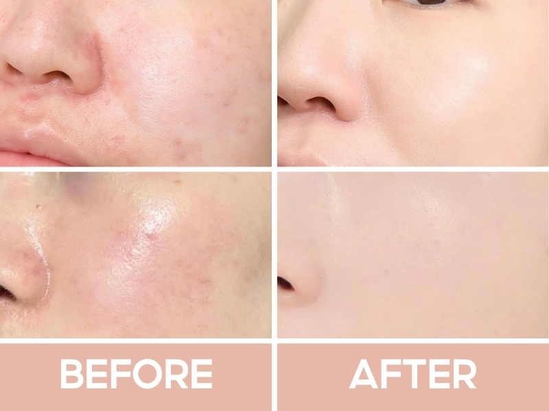 Trước và sau khi đánh nền Estee Lauder Double Wear