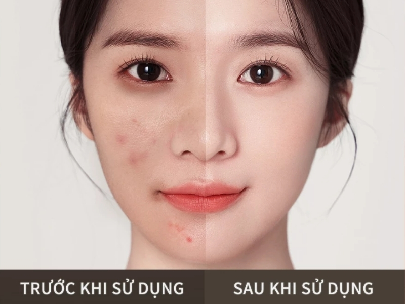 trước và sau khi sử dụng Focallure Fluid Foundation