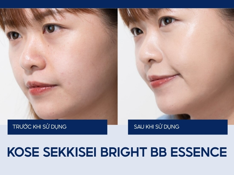 Kem nền Kose Sekkisei Bright BB Essence