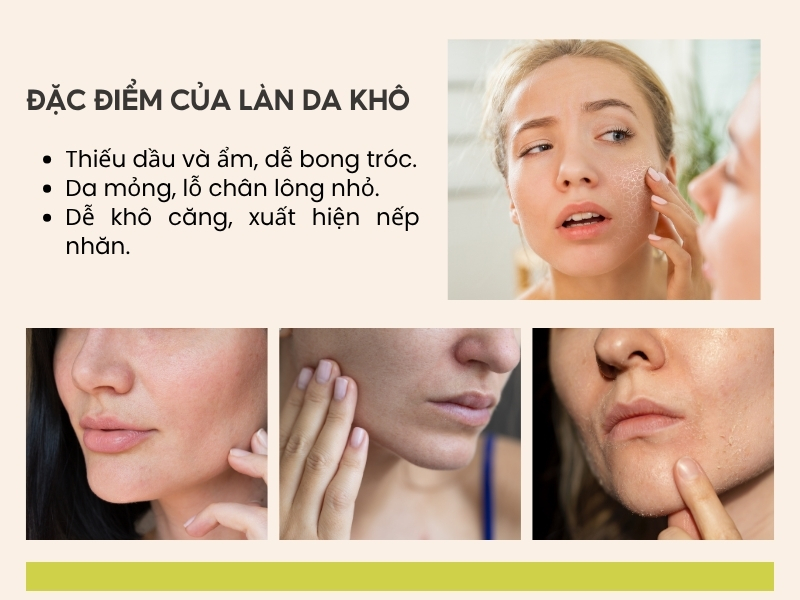 Các đặc điểm của làn da khô