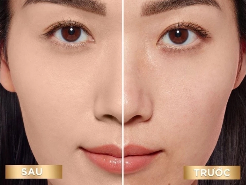 Kem nền L’oreal Paris 32h Matte Cover Foundation trước và sau