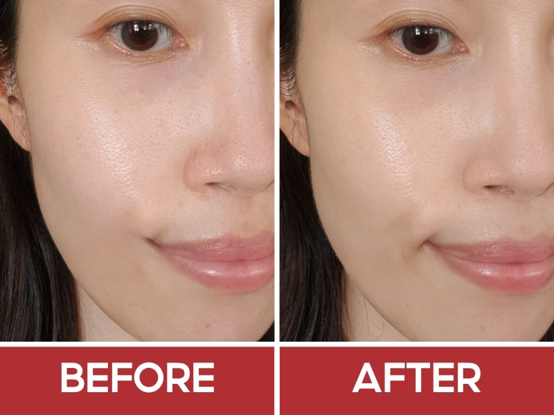 Trước và sau khi đánh kem nền serum L'Oreal Paris