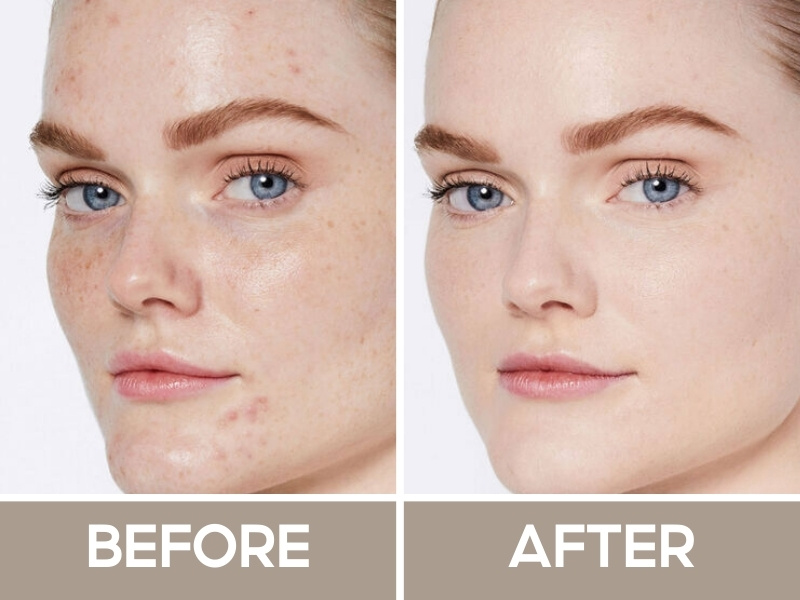 Trước và sau khi đánh kem nền Nars Light Reflecting