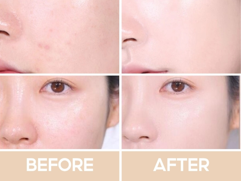 Trước và sau khi đánh kem nền Espoir Be Glow