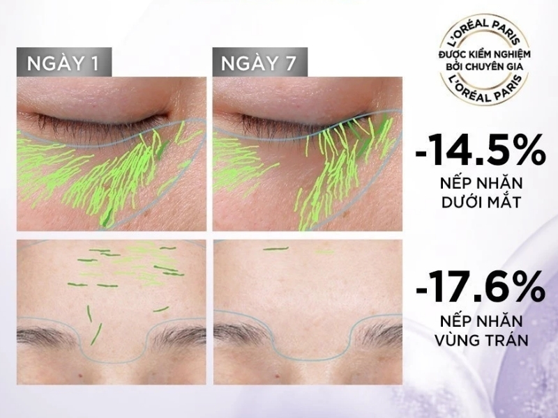 Serum L'Oréal Paris hiệu quả trên da