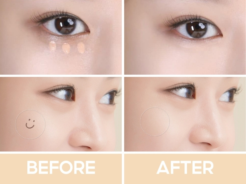 Trước và sau khi đánh che khuyết điểm Peripera