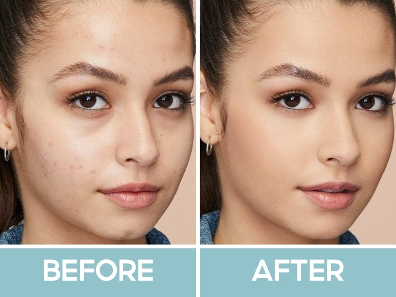 Trước và sau khi đánh che khuyết điểm Maybelline