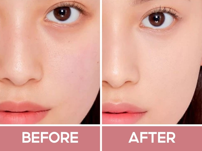Trước và sau khi dùng kem che khuyết điểm Focallure Liquid
