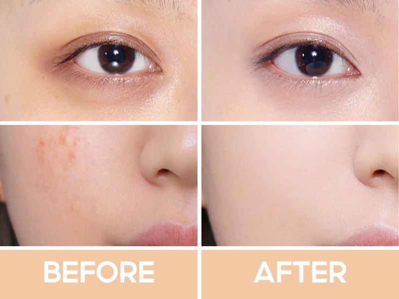 Trước và sau khi đánh Focallure Full Coverage Concealer