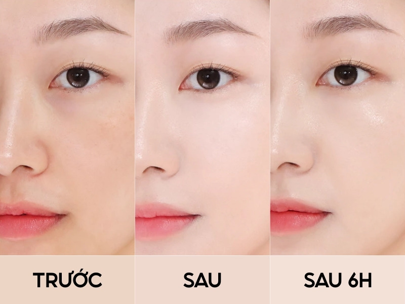 Trước và sau khi đánh che khuyết điểm BBIA