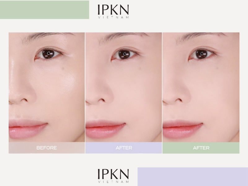 Trước và sau khi dùng phấn phủ bột IPKN