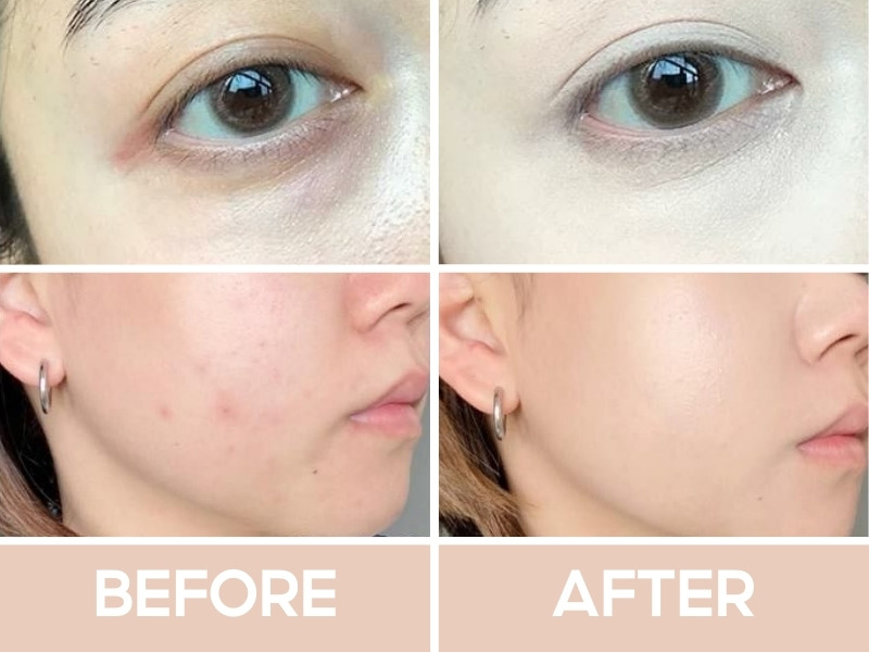 Trước và sau khi đánh che khuyết điểm Judydoll