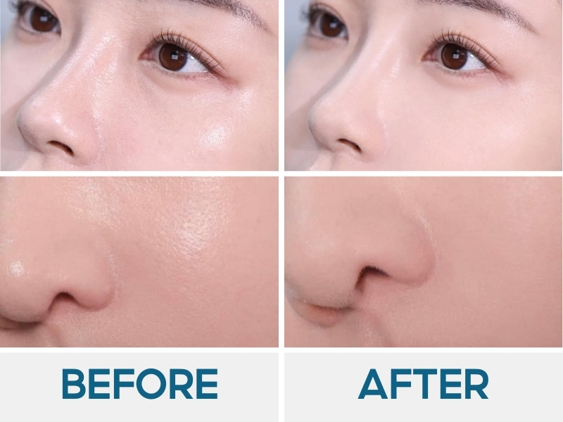 Trước và sau khi dùng Too Cool For School Artclass