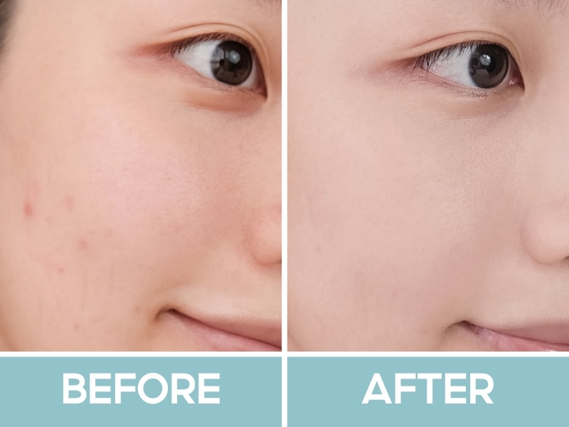 Trước và sau khi dùng kem lót Maybelline Fit Me