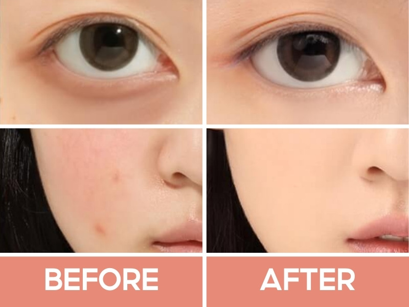 Trước và sau khi đánh Focallure Soft Matte Concealer