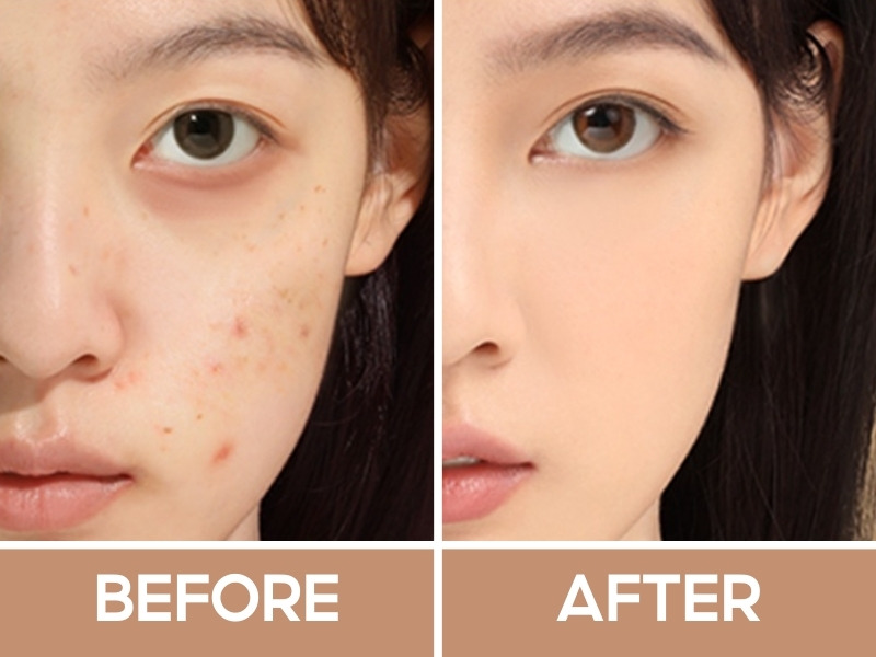 Trước và sau khi đánh bảng che khuyết điểm Focallure