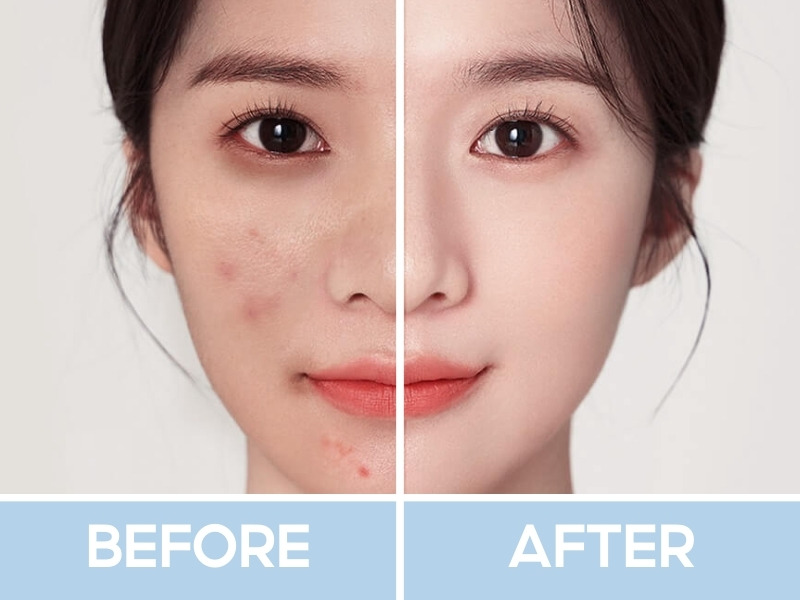 Trước và sau khi đánh che khuyết điểm Focallure Sanrio