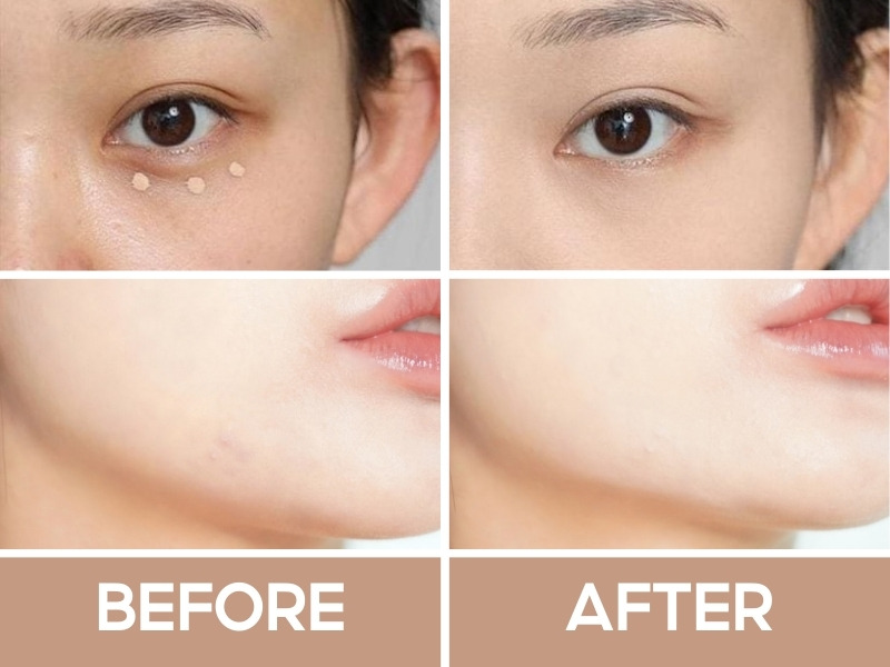 Trước và sau khi đánh che khuyết điểm the SAEM