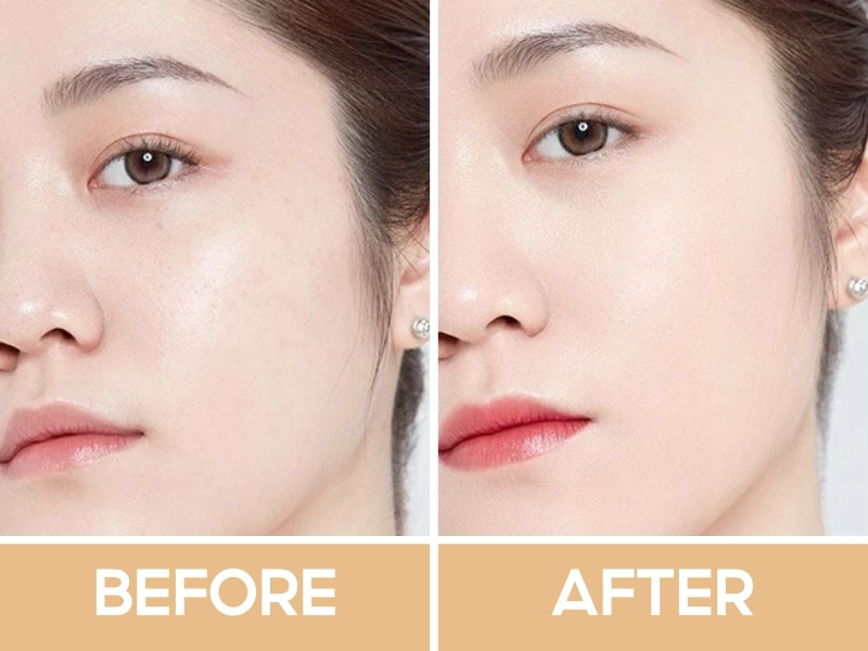 Trước và sau khi đánh che khuyết điểm Perfect Diary