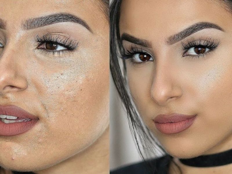 mốc nền trông như thế nào