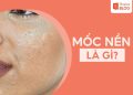 mốc nền là gì