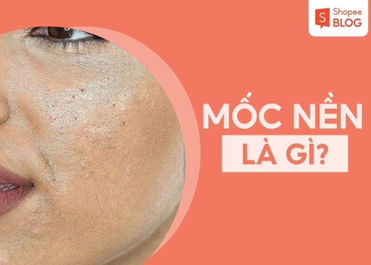 mốc nền là gì