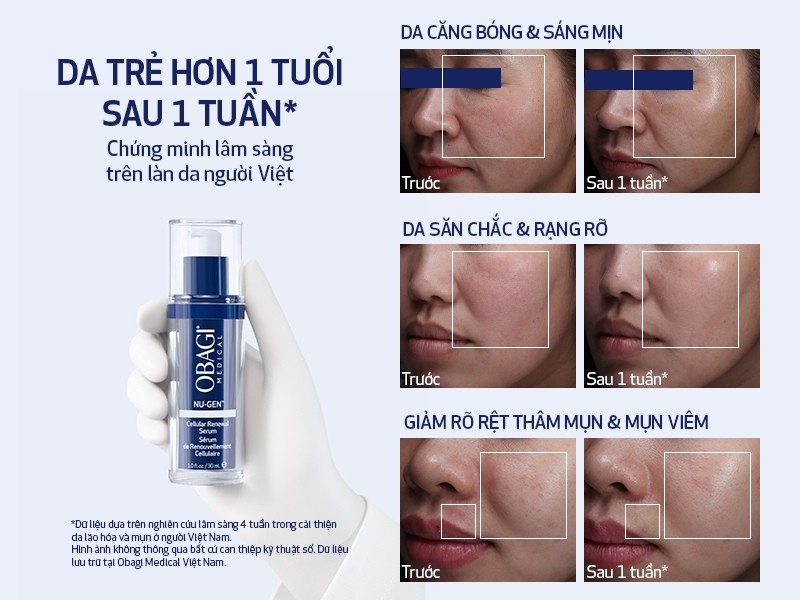 Hiệu quả lâm sàng của serum Obagi Nu-gen