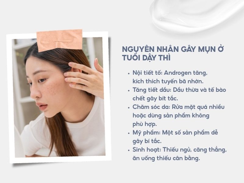 Nguyên nhân gây mụn ở tuổi dậy thì.