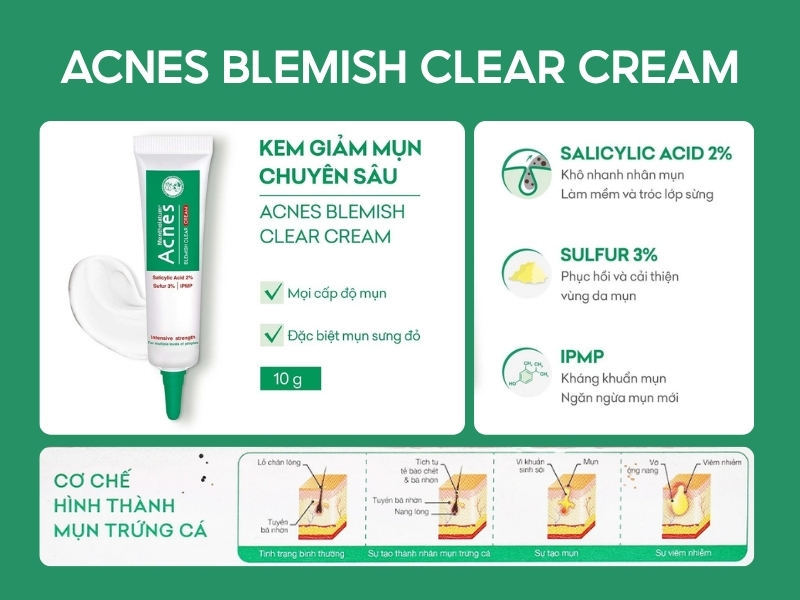 Kem trị mụn Acnes Blemish Clear Cream