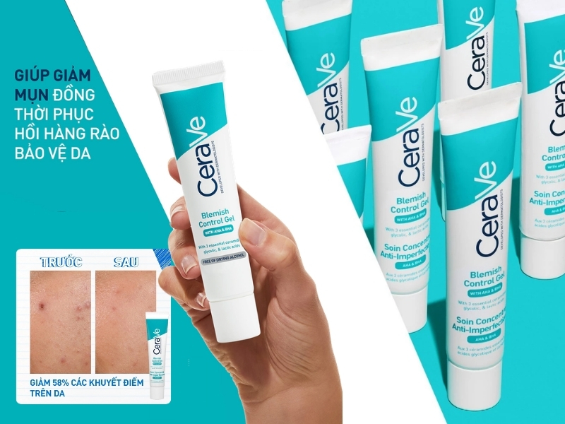 Gel trị mụn CeraVe Blemish Control Gel